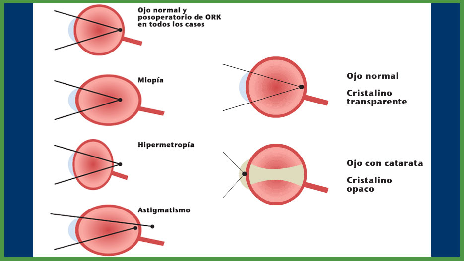 Vejarano Cosmetic & Laser Vision: la mejor clínica oftalmológica en Toluca